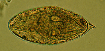 schistosoma japonicum