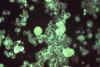 cytomeg-fluor.jpg (37776 bytes)